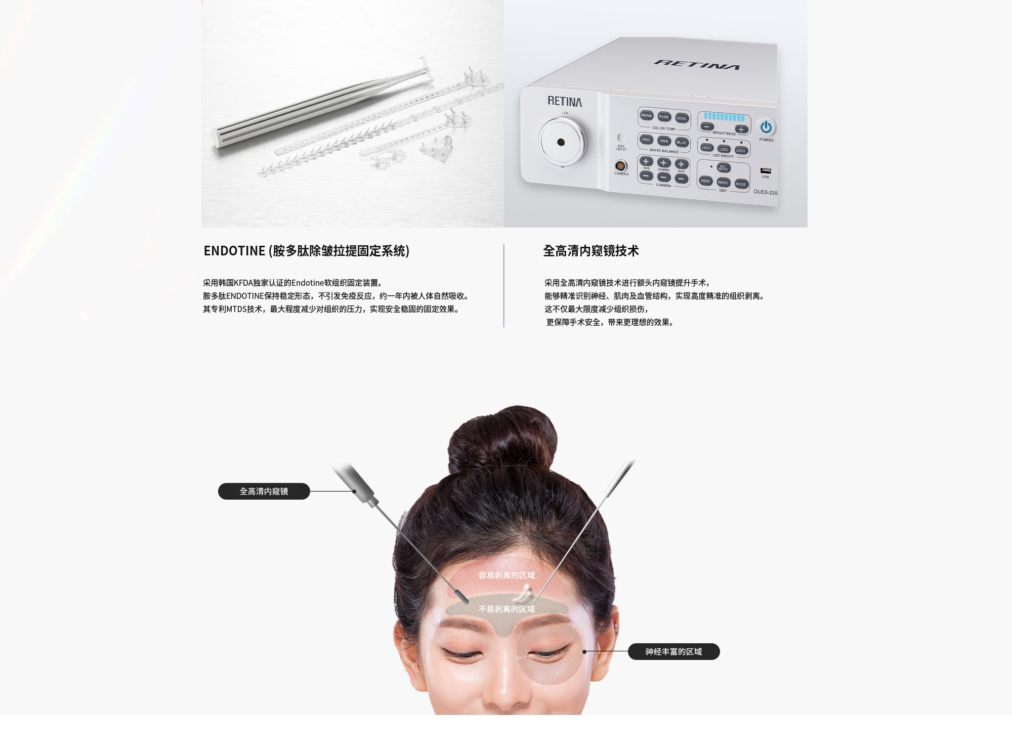 #ENDOTINE (胺多肽除皱拉提固定系统) : 采用韩国KFDA独家认证的Endotine软组织固定装置。胺多肽ENDOTINE保持稳定形态，不引发免疫反应，约一年内被人体自然吸收。其专利MTDS技术，最大程度减少对组织的压力，实现安全稳固的固定效果。| #全高清内窥镜技术 : 采用全高清内窥镜技术进行额头内窥镜提升手术，能够精准识别神经、肌肉及血管结构，实现高度精准的组织剥离。这不仅最大限度减少组织损伤， 更保障手术安全，带来更理想的效果。