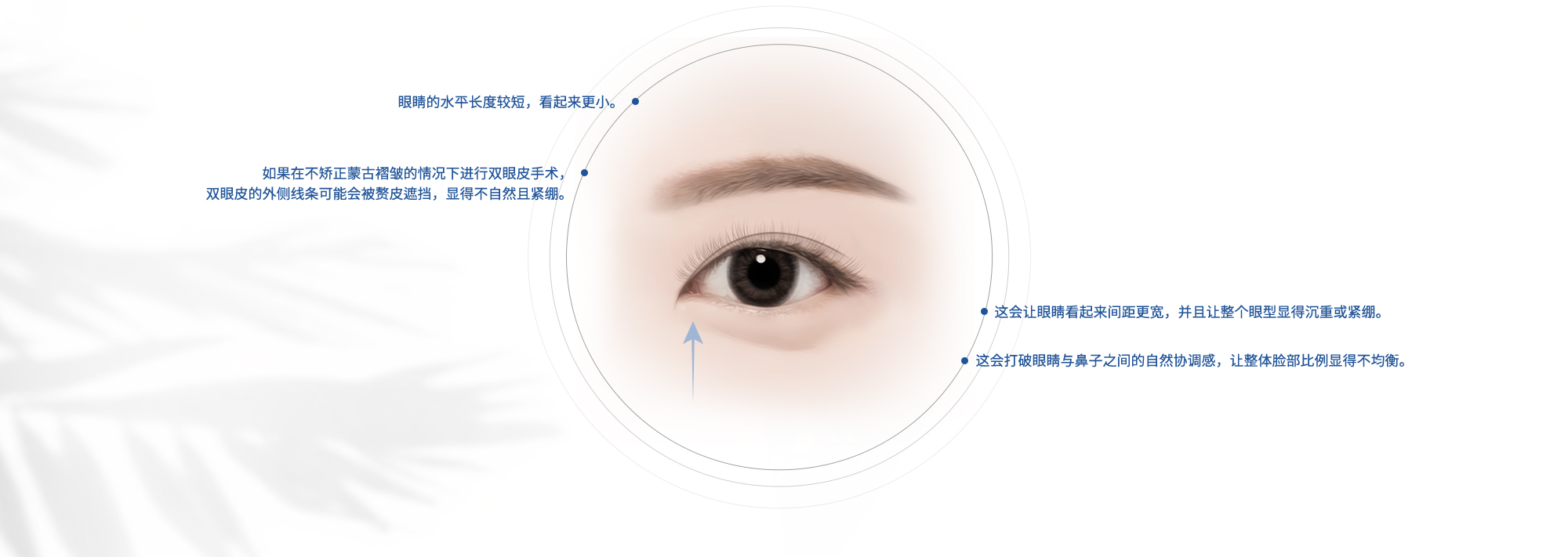 眼睛的水平长度较短，看起来更小。| 如果在不矫正蒙古褶皱的情况下进行双眼皮手术，双眼皮的外侧线条可能会被赘皮遮挡，显得不自然且紧绷。| 这会让眼睛看起来间距更宽，并且让整个眼型显得沉重或紧绷。| 这会打破眼睛与鼻子之间的自然协调感，让整体脸部比例显得不均衡。