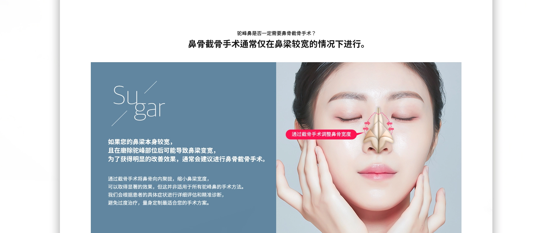 매부리코는 절골에 반드시 필요한가요?